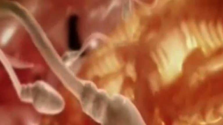 Quelques risques de l'utilisation de l'ordinateur portable sur la fertilité masculine